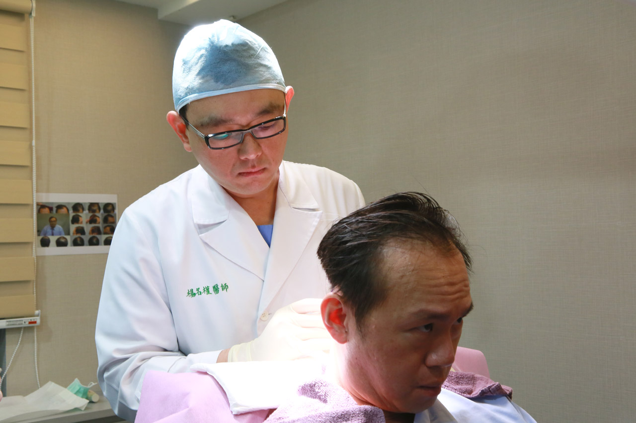 丁元凱,植髮,禿頭,禿髮